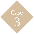 Case3