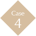 Case4